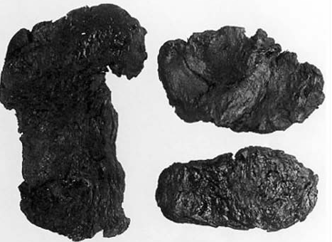 中国古代科学家的故事:钱乙造六味地黄丸插图1 中国古代科学家的故事:钱乙造六味地黄丸