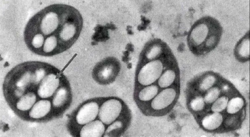 蓝藻知识科普:蓝藻爆发的原因及治理方法?插图1 蓝藻知识科普:蓝藻爆发的原因及治理方法?