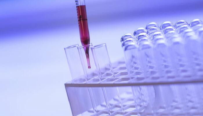 甲醛与新制氢氧化铜反应的化学方程式 甲醛与新制氢氧化铜反应现象插图2 甲醛与新制氢氧化铜反应的化学方程式 甲醛与新制氢氧化铜反应现象