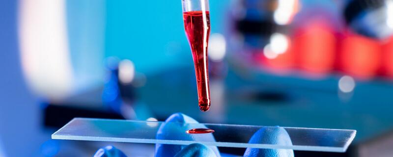 甲醛与新制氢氧化铜反应的化学方程式 甲醛与新制氢氧化铜反应现象插图1 甲醛与新制氢氧化铜反应的化学方程式 甲醛与新制氢氧化铜反应现象